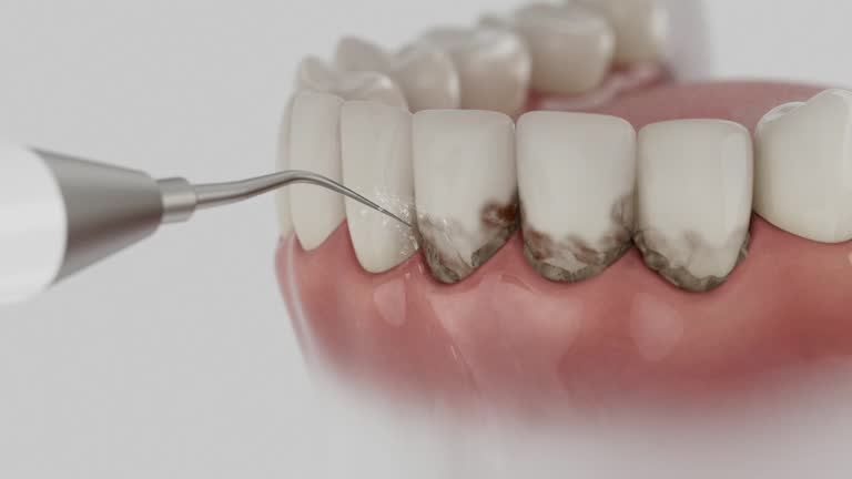 Reliable Dental contractor in Chickamauga, GA by Dentist Open Now
